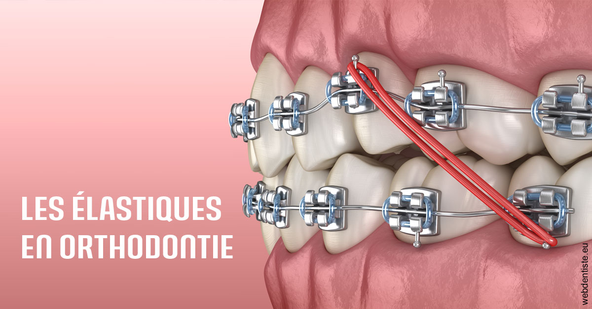 https://dr-nigoghossian-cecile.chirurgiens-dentistes.fr/Elastiques orthodontie 2