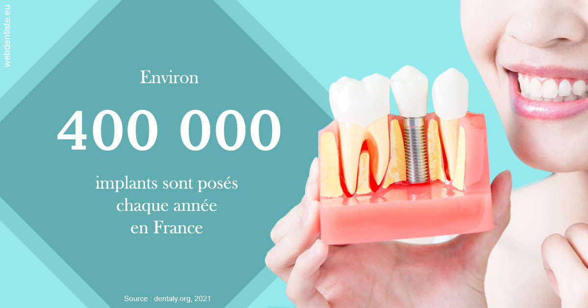 https://dr-nigoghossian-cecile.chirurgiens-dentistes.fr/Pose d'implants en France 2